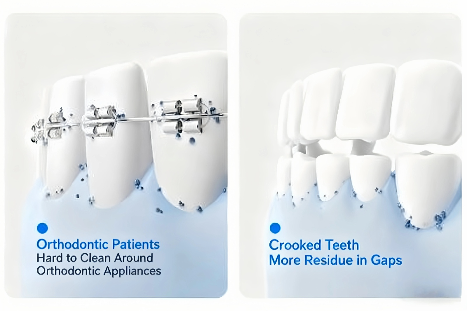 A comparison graphic showing the cleaning challenges for orthodontic patients with braces and individuals with crooked teeth, highlighting how the usmile C10 is designed to clean these hard-to-reach areas.